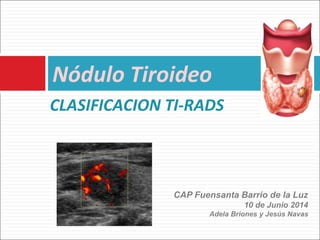 Nódulo Tiroideo 
CLASIFICACION TI-RADS 
CAP Fuensanta Barrio de la Luz 
10 de Junio 2014 
Adela Briones y Jesús Navas 
 