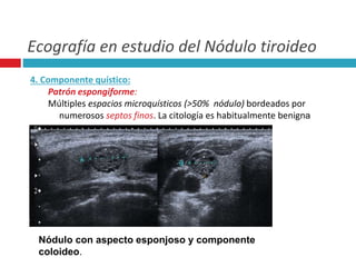 Ecografía en estudio del Nódulo tiroideo 
4. Componente quístico: 
Patrón espongiforme: 
Múltiples espacios microquísticos (>50% nódulo) bordeados por 
numerosos septos finos. La citología es habitualmente benigna 
Nódulo con aspecto esponjoso y componente 
coloideo. 
 