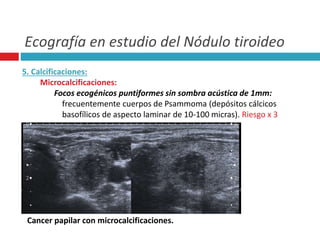 Ecografía en estudio del Nódulo tiroideo 
5. Calcificaciones: 
Microcalcificaciones: 
Focos ecogénicos puntiformes sin sombra acústica de 1mm: 
frecuentemente cuerpos de Psammoma (depósitos cálcicos 
basofílicos de aspecto laminar de 10-100 micras). Riesgo x 3 
Cancer papilar con microcalcificaciones. 
 