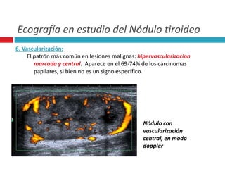 Ecografía en estudio del Nódulo tiroideo 
6. Vascularización: 
El patrón más común en lesiones malignas: hipervascularizacion 
marcada y central. Aparece en el 69-74% de los carcinomas 
papilares, si bien no es un signo específico. 
Nódulo con 
vascularización 
central, en modo 
doppler 
 