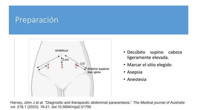PRESENTACION TORACENTESIS , PARACENTESIS Y PUNCION LUMBAR EN ENFERMERIA ...