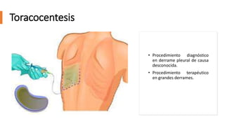 PRESENTACION TORACENTESIS , PARACENTESIS Y PUNCION LUMBAR EN ENFERMERIA ...