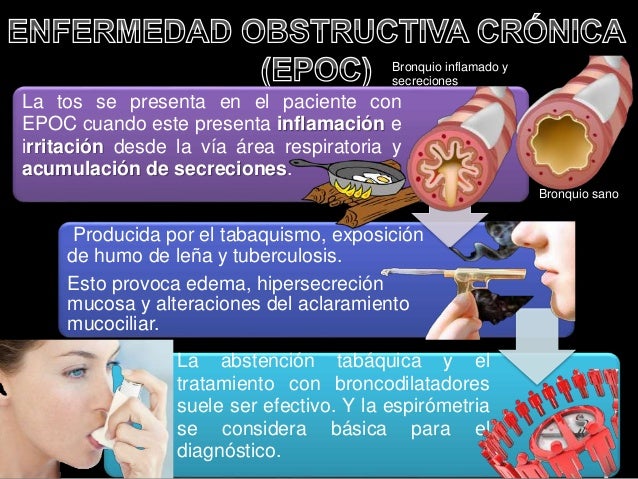 TOS, FISOPATOLOGÍA, CLASIFICACIÓN, EXAMENES Y TRATAMIENTO
