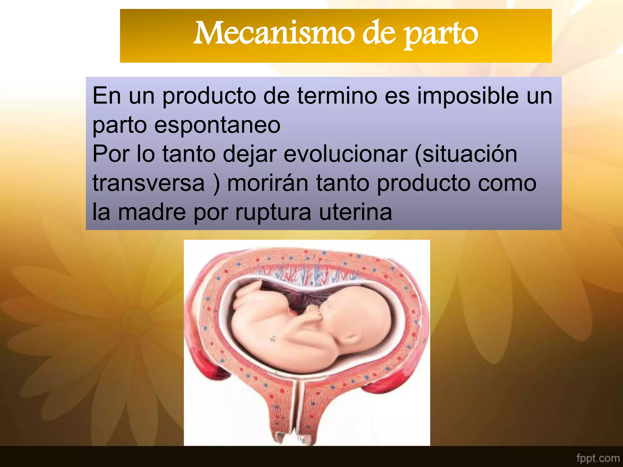 Presentacion transversa | PPT