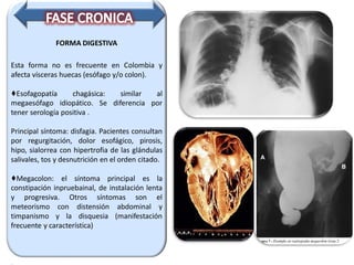 FORMA DIGESTIVA
Esta forma no es frecuente en Colombia y
afecta vísceras huecas (esófago y/o colon).
♦Esofagopatía chagásica: similar al
megaesófago idiopático. Se diferencia por
tener serología positiva .
Principal síntoma: disfagia. Pacientes consultan
por regurgitación, dolor esofágico, pirosis,
hipo, sialorrea con hipertrofia de las glándulas
salivales, tos y desnutrición en el orden citado.
♦Megacolon: el síntoma principal es la
constipación inpruebainal, de instalación lenta
y progresiva. Otros síntomas son el
meteorismo con distensión abdominal y
timpanismo y la disquesia (manifestación
frecuente y característica)
 