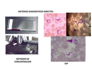 METODOS DE
CONCENTRACION
ESP
METODOS DIAGNOSTICOS DIRECTOS-
 