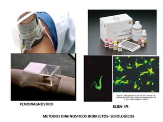 XENODIAGNOSTICO
ELISA- IFI
METODOS DIAGNOSTICOS INDIRECTOS- SEROLOGICOS
 