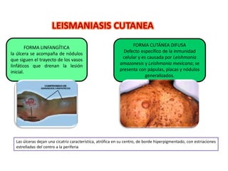LEISMANIASIS CUTANEA
Las úlceras dejan una cicatriz característica, atrófica en su centro, de borde hiperpigmentado, con estriaciones
estrelladas del centro a la periferia
FORMA LINFANGÍTICA
la úlcera se acompaña de nódulos
que siguen el trayecto de los vasos
linfáticos que drenan la lesión
inicial.
FORMA CUTÁNEA DIFUSA
Defecto específico de la inmunidad
celular y es causada por Leishmania
amazonesis y Leishmania mexicana; se
presenta con pápulas, placas y nódulos
generalizados.
 