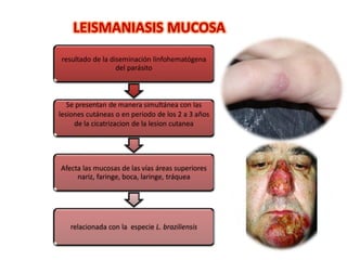 LEISMANIASIS MUCOSA
resultado de la diseminación linfohematógena
del parásito
Se presentan de manera simultánea con las
lesiones cutáneas o en periodo de los 2 a 3 años
de la cicatrizacion de la lesion cutanea
Afecta las mucosas de las vías áreas superiores
nariz, faringe, boca, laringe, tráquea
relacionada con la especie L. braziliensis
 
