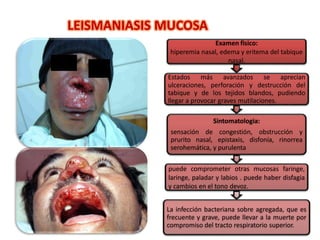 Examen fisico:
hiperemia nasal, edema y eritema del tabique
nasal.
Estados más avanzados se aprecian
ulceraciones, perforación y destrucción del
tabique y de los tejidos blandos, pudiendo
llegar a provocar graves mutilaciones.
Sintomatologia:
sensación de congestión, obstrucción y
prurito nasal, epistaxis, disfonía, rinorrea
serohemática, y purulenta
puede comprometer otras mucosas faringe,
laringe, paladar y labios . puede haber disfagia
y cambios en el tono devoz.
La infección bacteriana sobre agregada, que es
frecuente y grave, puede llevar a la muerte por
compromiso del tracto respiratorio superior.
LEISMANIASIS MUCOSA
 