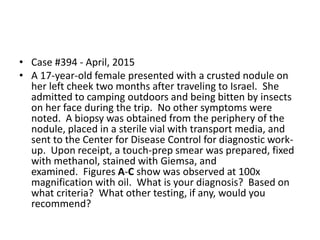 • Case #394 - April, 2015
• A 17-year-old female presented with a crusted nodule on
her left cheek two months after traveling to Israel. She
admitted to camping outdoors and being bitten by insects
on her face during the trip. No other symptoms were
noted. A biopsy was obtained from the periphery of the
nodule, placed in a sterile vial with transport media, and
sent to the Center for Disease Control for diagnostic work-
up. Upon receipt, a touch-prep smear was prepared, fixed
with methanol, stained with Giemsa, and
examined. Figures A-C show was observed at 100x
magnification with oil. What is your diagnosis? Based on
what criteria? What other testing, if any, would you
recommend?
 