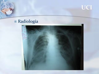 UCI
 Radiología
 
