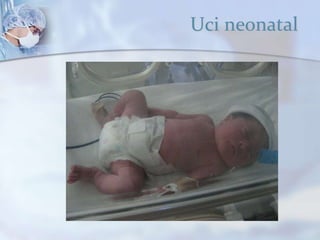 Uci neonatal
 