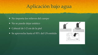 Aplicación bajo agua
 No importa los relieves del cuerpo
 No se puede dejar estático
 Cabezal de 1-2 cm de la piel
 Se aprovecha hasta el 95% del US emitido
 