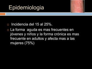 Epidemiologia

    Incidencia del 15 al 25%.
   La forma aguda es mas frecuentes en
    jóvenes y niños y la forma crónica es mas
    frecuente en adultos y afecta mas a las
    mujeres (75%)
 