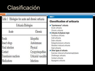Clasificación
 