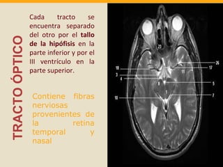 TRACTO ÓPTICO 
Cada tracto se 
encuentra separado 
del otro por el tallo 
de la hipófisis en la 
parte inferior y por el 
III ventrículo en la 
parte superior. 
Contiene fibras 
nerviosas 
provenientes de 
la retina 
temporal y 
nasal 
 