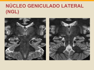 NÚCLEO GENICULADO LATERAL 
(NGL) 
 