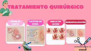 Comprehensive Overview of Bartolinitis: Anatomy, Diagnosis, and ...