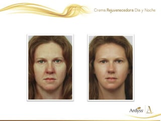 Presentación Skin Care Ardyss