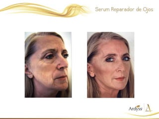 Presentación Skin Care Ardyss