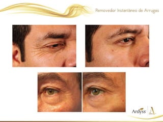 Presentación Skin Care Ardyss