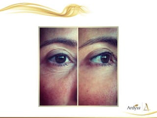 Presentación Skin Care Ardyss
