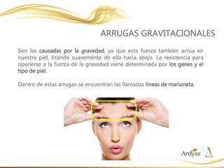 Son las causadas por la gravedad, ya que esta fuerza también actúa en
nuestra piel, tirando suavemente de ella hacia abajo. La resistencia para
oponerse a la fuerza de la gravedad viene determinada por los genes y el
tipo de piel.
Dentro de estas arrugas se encuentran las llamadas líneas de marioneta.
ARRUGAS GRAVITACIONALES
 