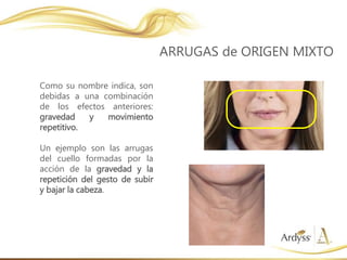 Como su nombre indica, son
debidas a una combinación
de los efectos anteriores:
gravedad y movimiento
repetitivo.
Un ejemplo son las arrugas
del cuello formadas por la
acción de la gravedad y la
repetición del gesto de subir
y bajar la cabeza.
ARRUGAS de ORIGEN MIXTO
 