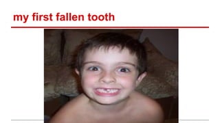 my first fallen tooth

 