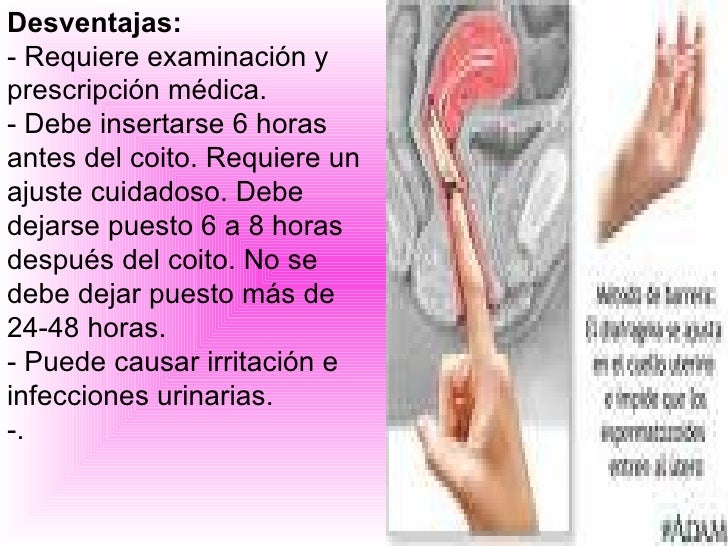 La máscara a la persona del ungüento radevit