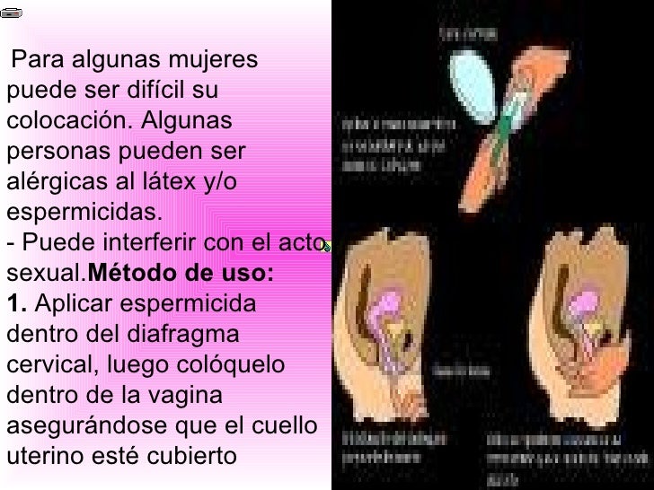 La ducha láser sobre la persona