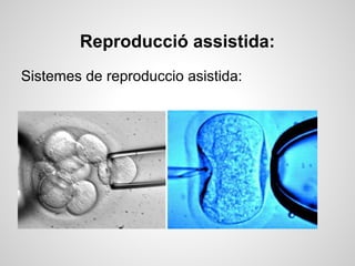Reproducció assistida:
Sistemes de reproduccio asistida:
 