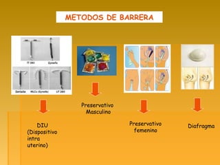 METODOS DE BARRERA
DIU
(Dispositivo
intra
uterino)
Preservativo
Masculino
Preservativo
femenino
Diafragma
 