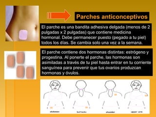 Parches anticonceptivos
El parche es una bandita adhesiva delgada (menos de 2
pulgadas x 2 pulgadas) que contiene medicina
hormonal. Debe permanecer puesto (pegado a tu piel)
todos los días. Se cambia solo una vez a la semana.
El parche contiene dos hormonas distintas: estrógeno y
progestina. Al ponerte el parche, las hormonas son
asimiladas a través de tu piel hasta entrar en tu corriente
sanguínea para prevenir que tus ovarios produzcan
hormonas y óvulos.
 