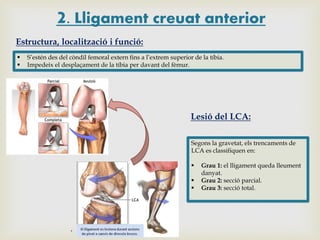 2. Lligament creuat anterior
Estructura, localització i funció:



S’estén des del còndil femoral extern fins a l’extrem superior de la tíbia.
Impedeix el desplaçament de la tíbia per davant del fèmur.

Lesió del LCA:
Segons la gravetat, els trencaments de
LCA es classifiquen en:




Grau 1: el lligament queda lleument
danyat.
Grau 2: secció parcial.
Grau 3: secció total.

 