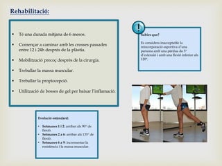 Rehabilitació:



Té una durada mitjana de 6 mesos.

Sabies que?



Començar a caminar amb les crosses passades
entre 12 i 24h després de la plàstia.



Mobilització precoç després de la cirurgia.

Es considera inacceptable la
reincorporació esportiva d’una
persona amb una pèrdua de 5
d’extensió i amb una flexió inferior als
120.



Treballar la massa muscular.



Treballar la propiocepció.



Utilització de bosses de gel per baixar l’inflamació.

Evolució estàndard:
• Setmanes 1 i 2: arribar als 90 de
flexió.
• Setmanes 2 a 6: arribar als 135 de
flexió.
• Setmanes 6 a 9: incrementar la
resistència i la massa muscular.

 