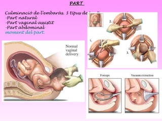 PART  Culminació de l’embaràs. 3 tipus de part: -Part natural -Part vaginal assistit -Part abdominal  moment del part. 