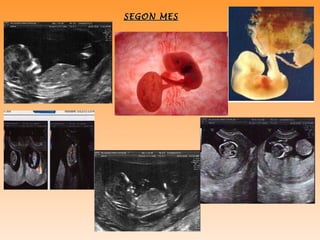 SEGON MES 