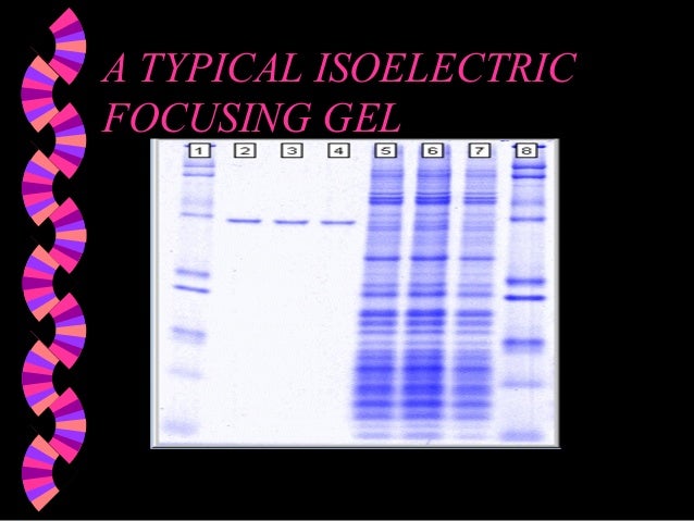 determination of isoelectric point