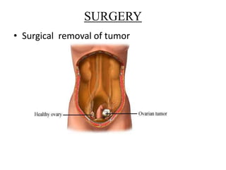 SURGERY
• Surgical removal of tumor
 