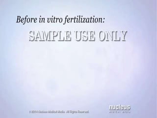INVITRO FERTILIZATION AND
EMBRYO TRANSFER [ IVF-ET]
 