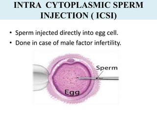 INTRA CYTOPLASMIC SPERM
INJECTION ( ICSI)
• Sperm injected directly into egg cell.
• Done in case of male factor infertility.
 