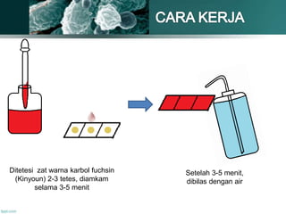 Ditetesi zat warna karbol fuchsin
(Kinyoun) 2-3 tetes, diamkam
selama 3-5 menit
Setelah 3-5 menit,
dibilas dengan air
 