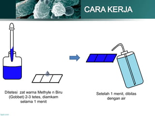 Ditetesi zat warna Methyle n Biru
(Gobbet) 2-3 tetes, diamkam
selama 1 menit
Setelah 1 menit, dibilas
dengan air
 