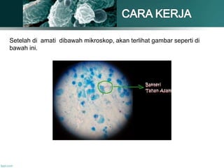 Setelah di amati dibawah mikroskop, akan terlihat gambar seperti di
bawah ini.
 