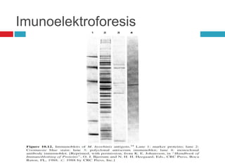 Imunoelektroforesis
 