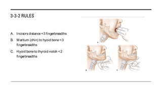 Presentasi Airway Management_Residen Semester 1.pdf