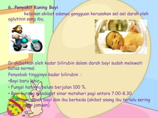 6. Penyakit Kuning Bayi
kelainan akibat adanya gangguan kerusakan sel-sel darah oleh
aglutinin sang ibu.

Di akibatkan oleh kadar bilirubin dalam darah bayi sudah melewati
batas normal.
Penyebab tingginya kadar bilirubin :
•Bayi baru lahir.
• Fungsi hatinya belum berjalan 100 %.
• Bayi kurang mendapat sinar matahari pagi antara 7.00-8.30.
• Golongan darah bayi dan ibu berbeda (akibat ssang ibu terlalu sering
minum jamu-jamuan)

 