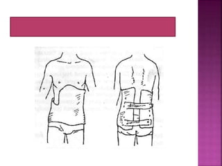 Tulang dan Persendian